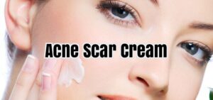 10-best-Acne-scar-removal-creams-work-pretty-well